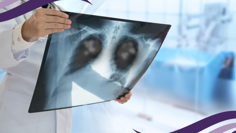 Advancing Sustainable Cancer Screening in Europe within the Joint Action EUCanScreen WP4