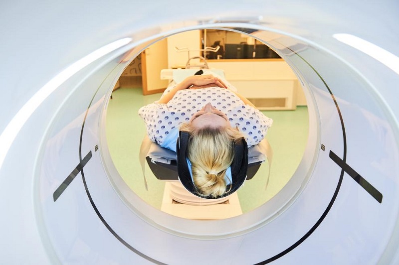 ECIS Highlights Increase in Lung Cancer Among Women in Europe