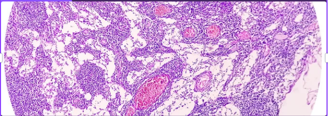 gastric cancer cell